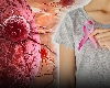 क्या होता है Invasive Breast Cancer? जानिए इसके लक्षण