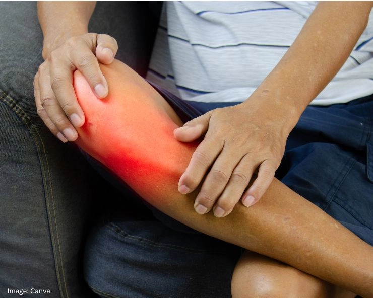Joint Pain Remedies