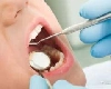 Career in PHD Orthodontics : पीएचडी ऑर्थोडॉन्टिक्स मध्ये करिअर  बनवा, पात्रता, अभ्यासक्रम, व्याप्ती जाणून घ्या