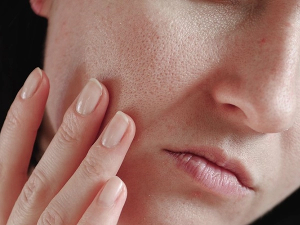 Skin Health: ചര്‍മ്മപ്രശ്‌നങ്ങള്‍ക്ക് പ്രധാന കാരണം ഈ ഭക്ഷണങ്ങള്‍