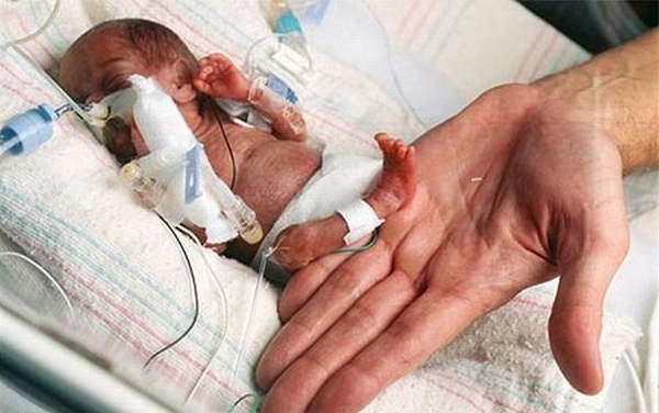 जगातील सर्वात लहान बाळ जन्मले एमिलिया “छोटी योद्धा”