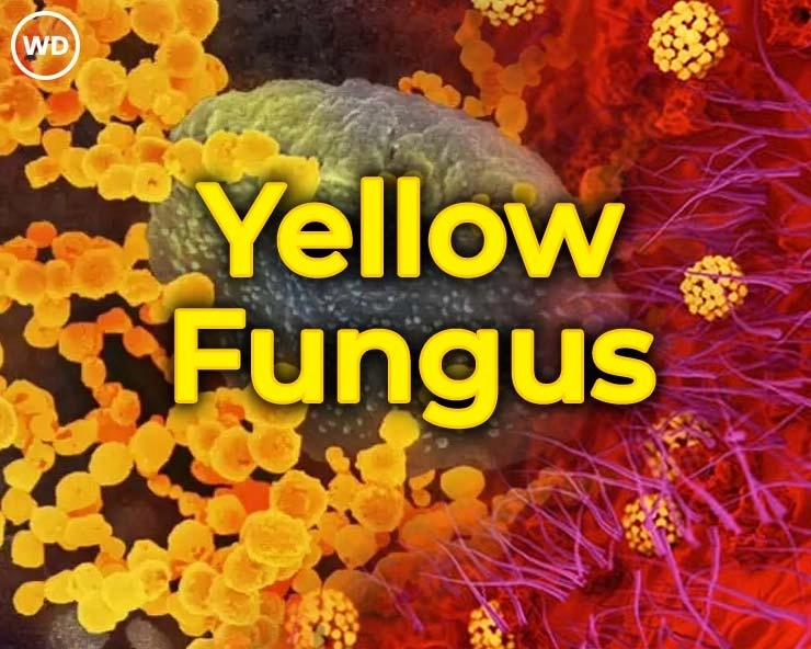 'Yellow Fungus’ अधिक धोकादायक, जाणून घ्या लक्षणं