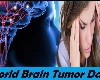World brain tumor day : ब्रेन ट्यूमरची कारणे आणि लक्षणे