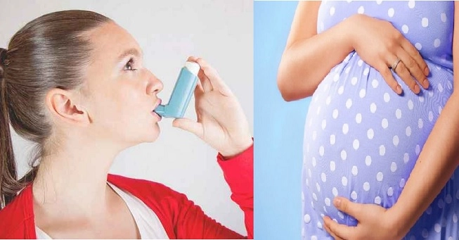 Asthma and pregnancy