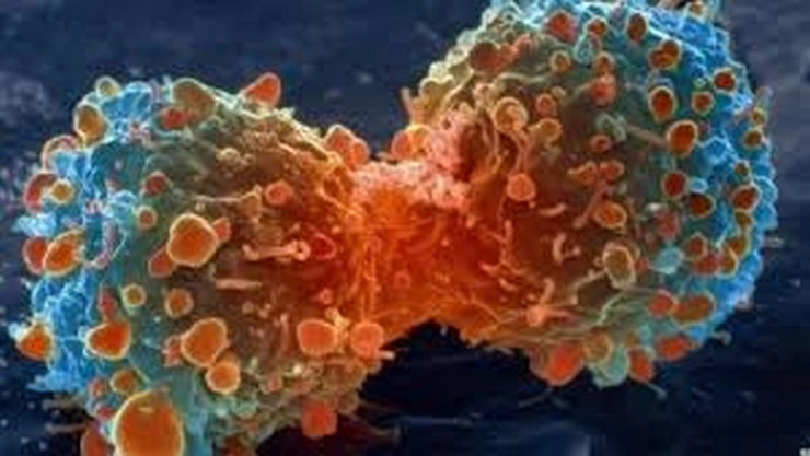 सरत्या वयात कोलोन कर्करोग किती धोकादायक आहे, याची मुख्य कारणे आणि संरक्षणाच्या पद्धती जाणून घेऊ या...
