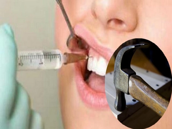 दात काढत आहात सावधान, दातांची शस्त्रक्रिया करतांना मुलीचा मृत्यू