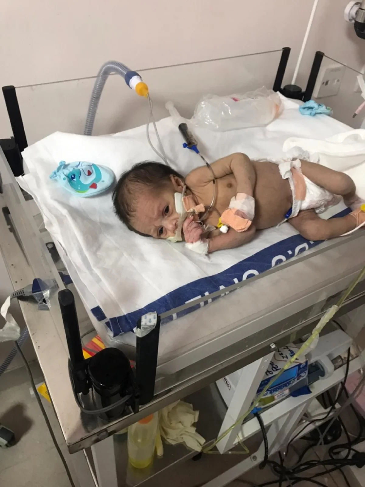 corona virus infected kids no symptoms