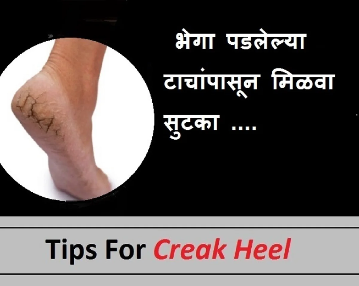creak heel