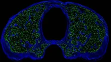 Scientists discover new 'immune hubs' in skull bone marrow Scientists discover new 'immune hubs' in skull bone marrow