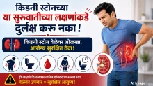 किडनी स्टोनच्या या सुरुवातीच्या लक्षणांकडे दुर्लक्ष करू नका किडनी स्टोनच्या या सुरुवातीच्या लक्षणांकडे दुर्लक्ष करू नका