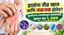 हातांना तीव्र खाज आणि जळजळ होतेय? बुरशीजन्य संसर्गापासून बचावासाठी जाणून घ्या ५ उपाय हातांना तीव्र खाज आणि जळजळ होतेय? बुरशीजन्य संसर्गापासून बचावासाठी जाणून घ्या ५ उपाय