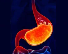 Acidity, అసిడిటీ తగ్గించుకోవడానికి చిట్కాలు