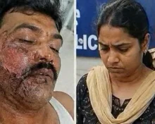 మటన్ కూర బాగోలేదన్న భర్త... కొరివితో మూతి కాల్చిన భార్య...