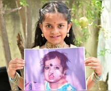 క్లెఫ్ట్స్- గ్రహణం మొర్రి ముందస్తు నిర్ధారణ కోసం అవగాహనకు స్మైల్ ట్రైన్ ఇండియా కృషి