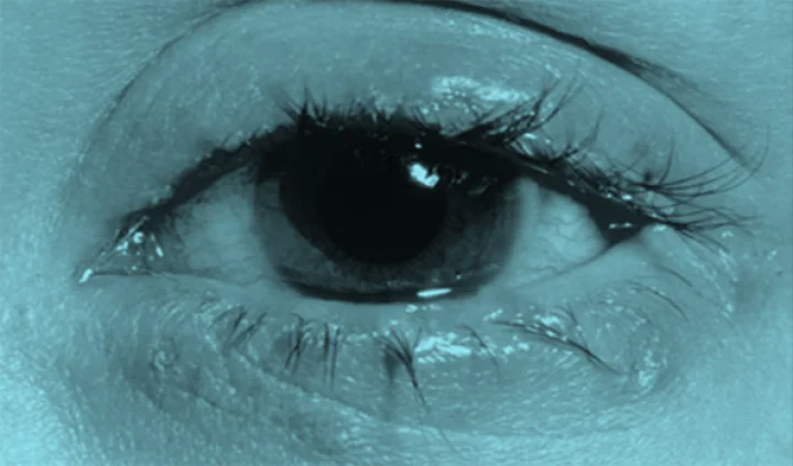 Trachoma