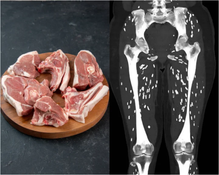 ‘Craziest’ CT scan shows how eating undercooked pork affects the body