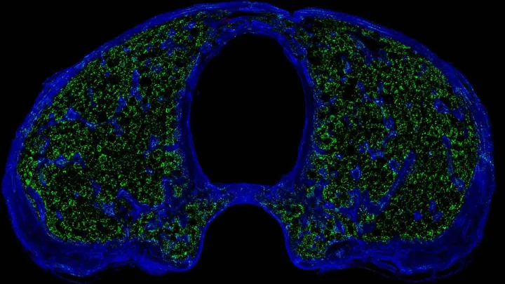 Scientists discover new 'immune hubs' in skull bone marrow