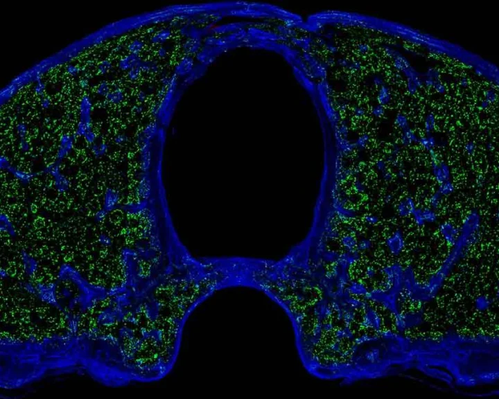 Scientists discover new 'immune hubs' in skull bone marrow
