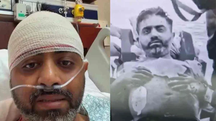 'Skull Bone Broke and Sank Inward': Captain Smit Machchhar’s Terrifying Injury After Axe Attack By Omani Co-Pilot Revealed