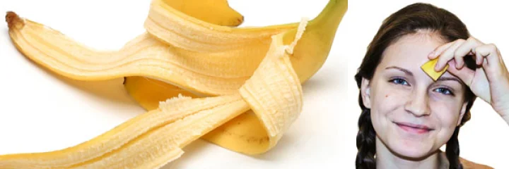 કેળા