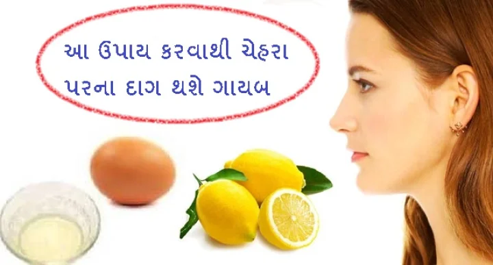 ચેહરા પરના દાગ