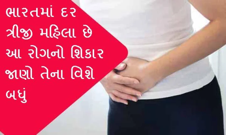 Pelvic Congestion Syndrome