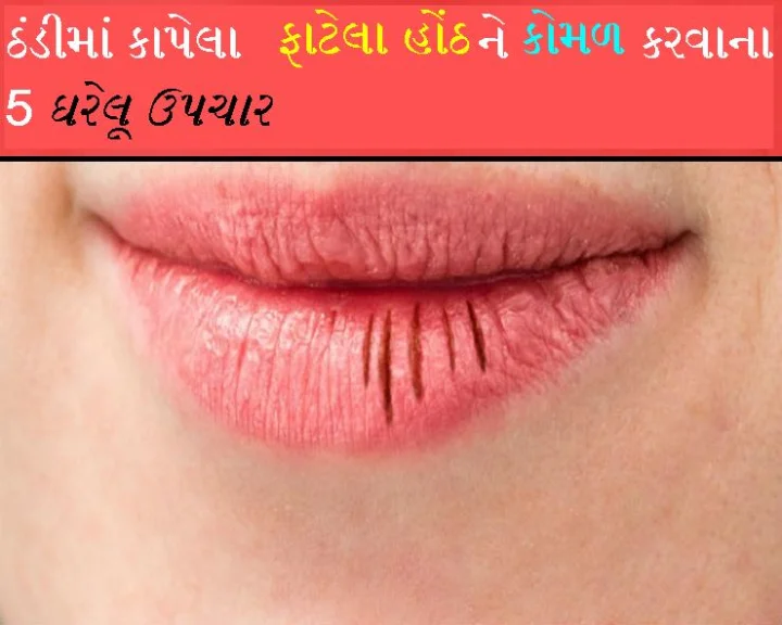 Cracked Lips