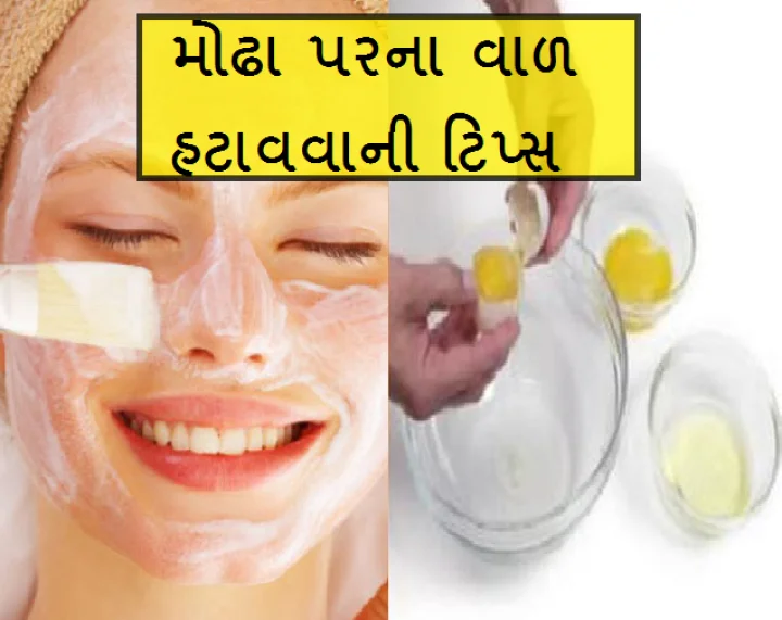 ચહેરાના અણગમતા વાળ