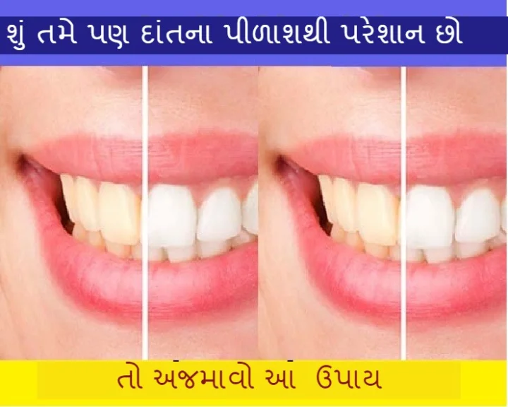 teeth