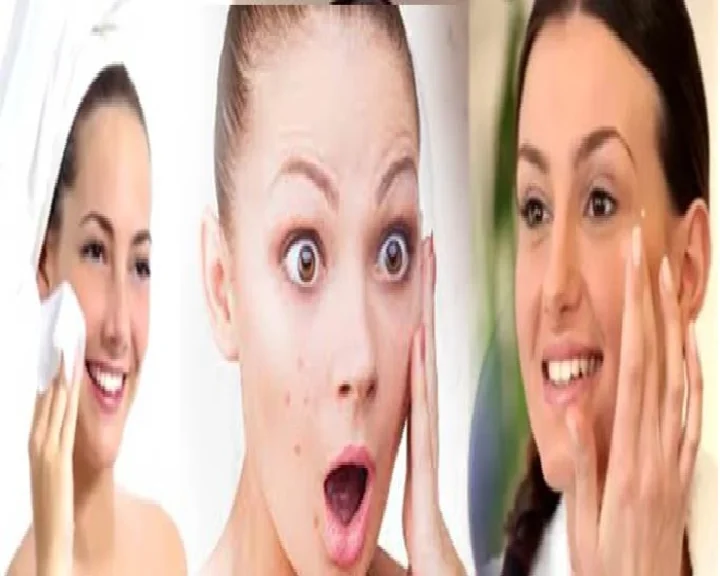 pimple removing tips