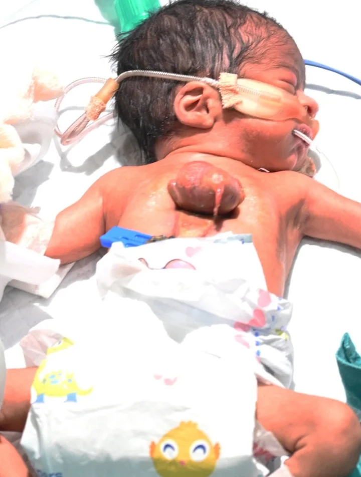 child heart outside on the body