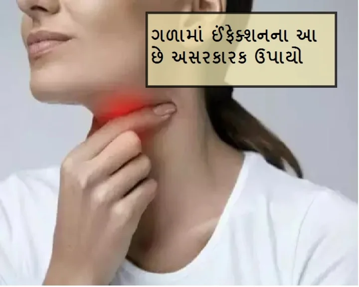 throat infection