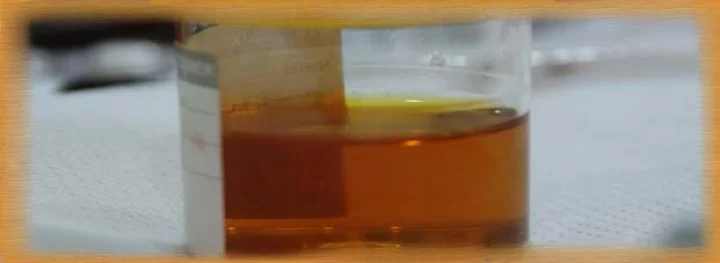 The woman had been drinking urine for four years