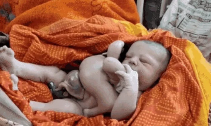4 હાથ 4 પગવાળા બાળકની ફોટો  VIRAL