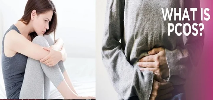 PCOS