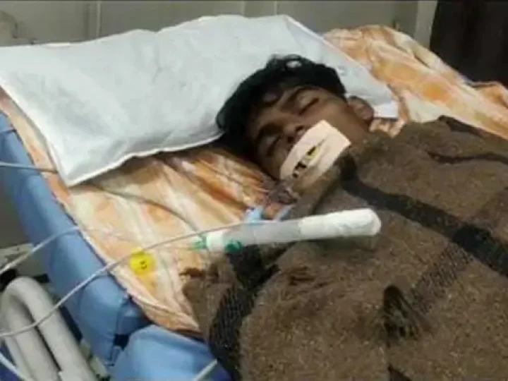 Son bitten by a snake