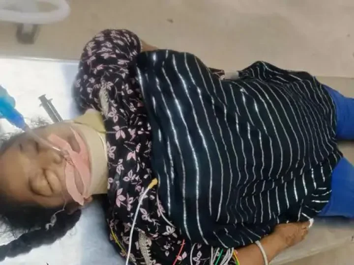 From the 12th floor, a girl who underwent dialysis at SVP Hospital