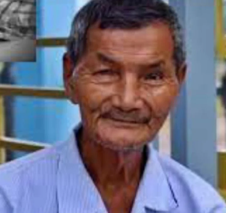 This person has not slept for 60 years