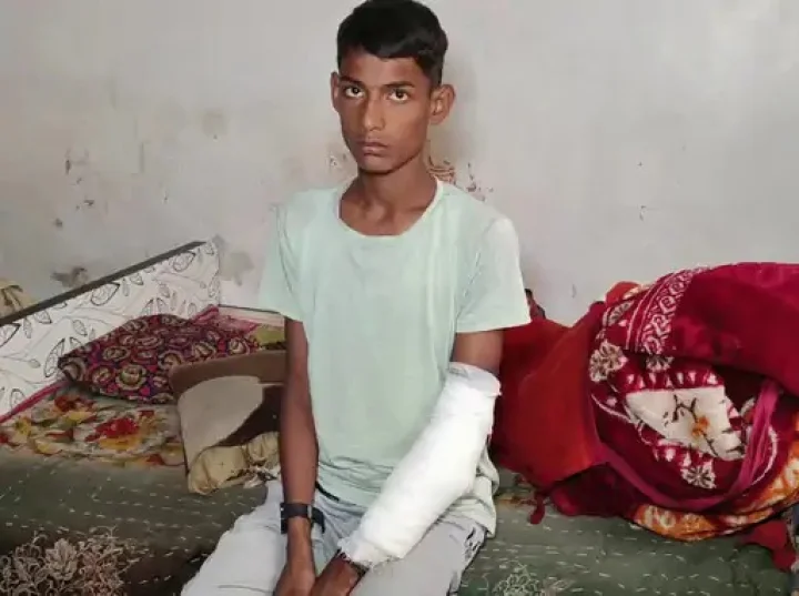 Two students were electrocuted while pulling a rope