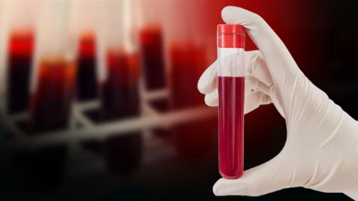 blood group