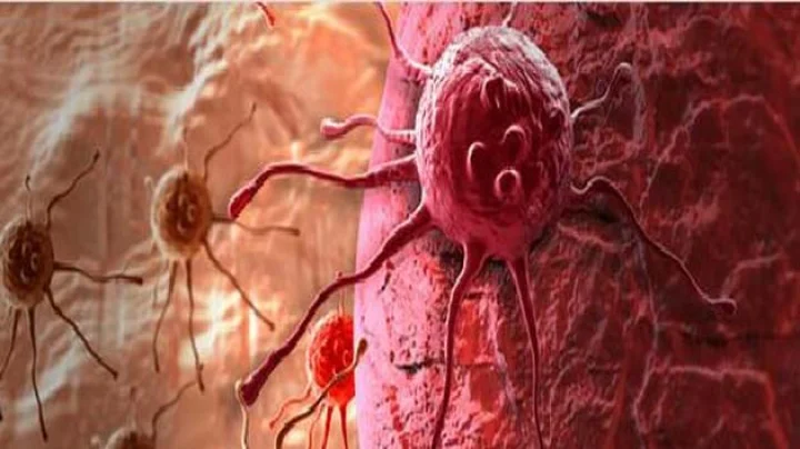 Cervical cancer