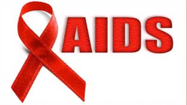 HIV test