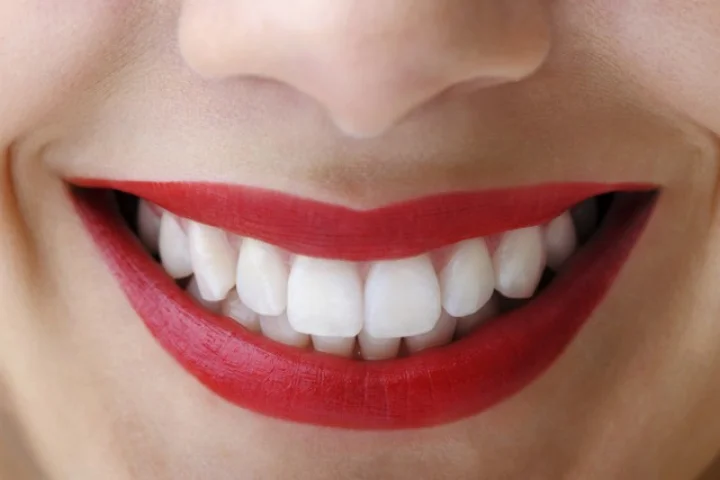 Teeth cleaning