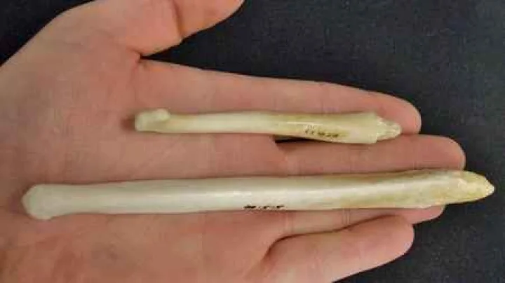 लाखो वर्षांपूर्वी मनुष्याच्या लिंगात होते हाड!