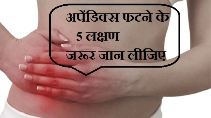 अपेंडि‍साइटिस के 5 लक्षण