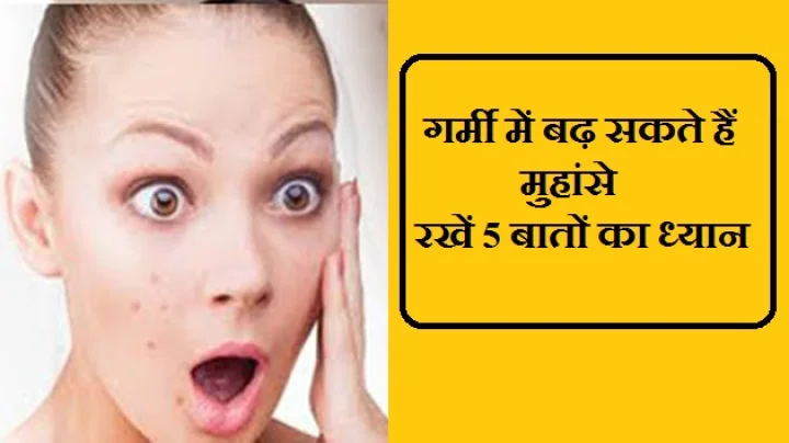 मुहांसे