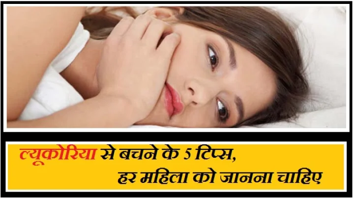 ल्यूकोरिया