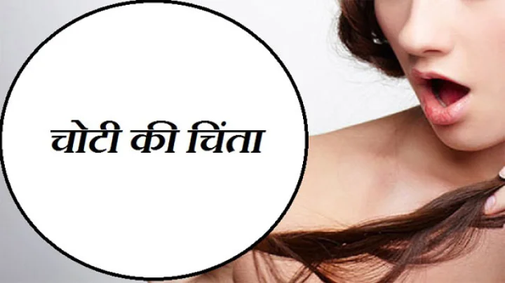 चोटी