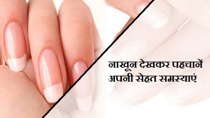 नाखून देखकर पहचान सकते हैं बीमारी, जानें 10 टिप्स