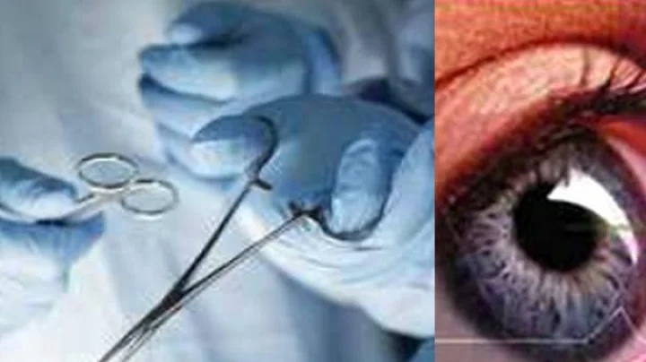 Cataract operation